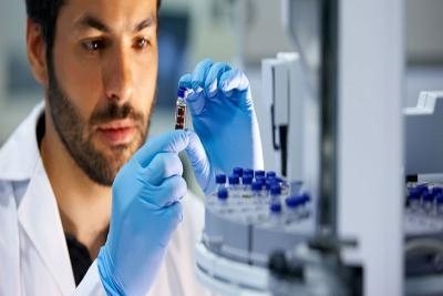 Kompletna analiza polnih hormona LH, FSH, prolaktin, progesteron, testosteron, estradiol